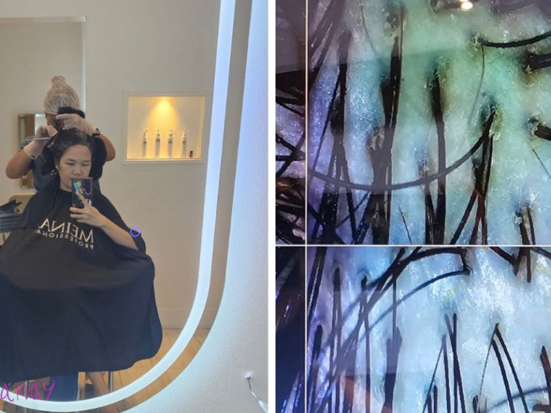 Why a Bagong Nanay Needs a Scalp Care Day,&nbsp;ASAP