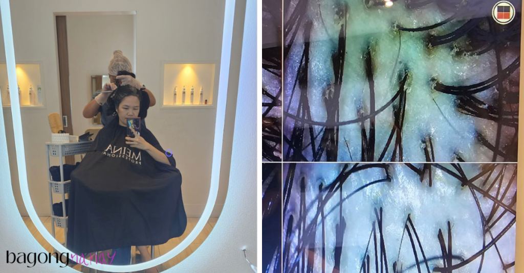 meinas scalp treatment review